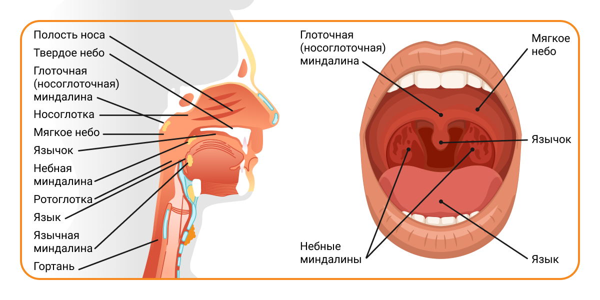 Воспаленное горло