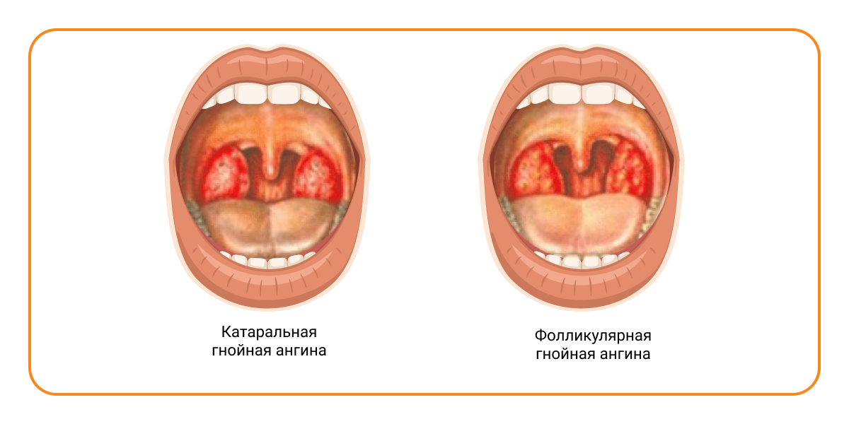 Выберите ваш город