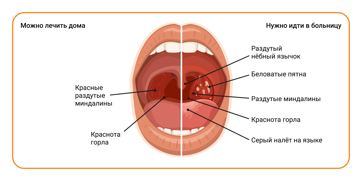 Что это такое?