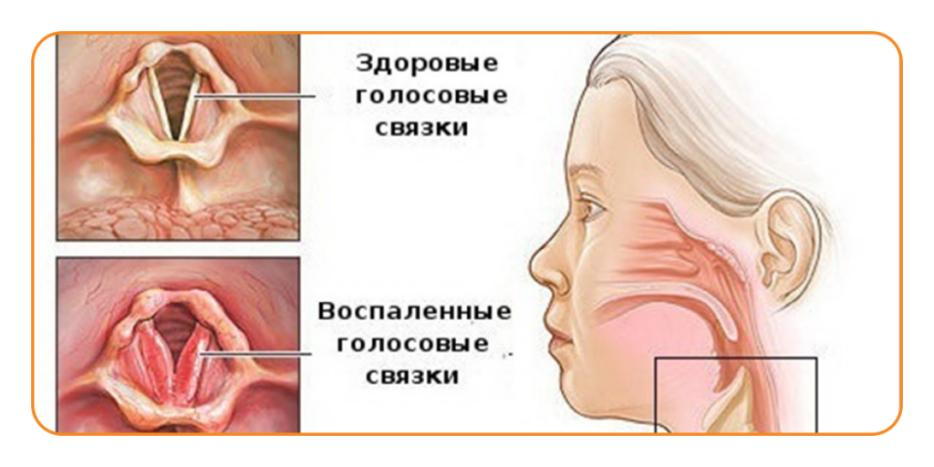 Почему поменялся голос