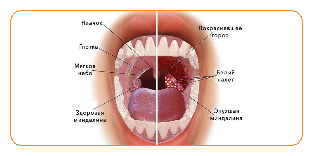 Как должно выглядеть здоровое горло (фото)? Стоковые фотографии по запросу Здоровое горло